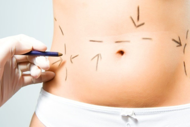 Metoder för bukplastik