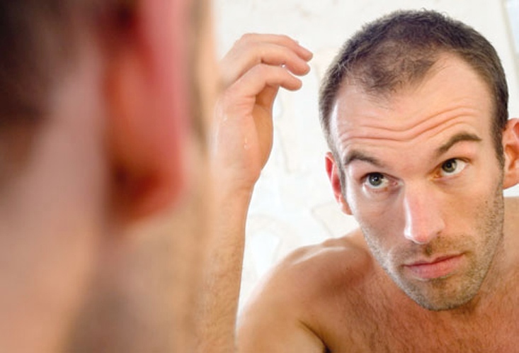 Orsaker till håravfall hos kvinnor och män