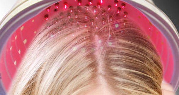 Laserbehandling (hårlaser) mot håravfall